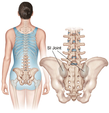 Spine Associates – Sacroiliac Joint Syndrome