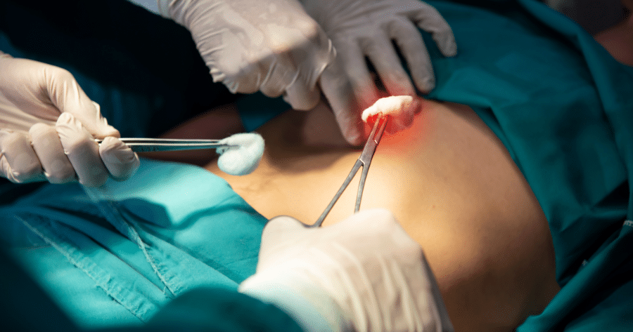 Minimally Invasive Spine Surgeons in Houston & Beaumont, TX (1) Minimally Invasive Spine Surgeons in Houston & Beaumont, TX