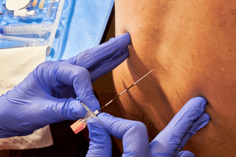 Epidural Steroid Injections in Houston and Beaumont, TX