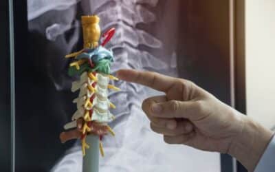 Cervical and Lumbar Radiculopathy: Symptoms, Causes, and Treatment