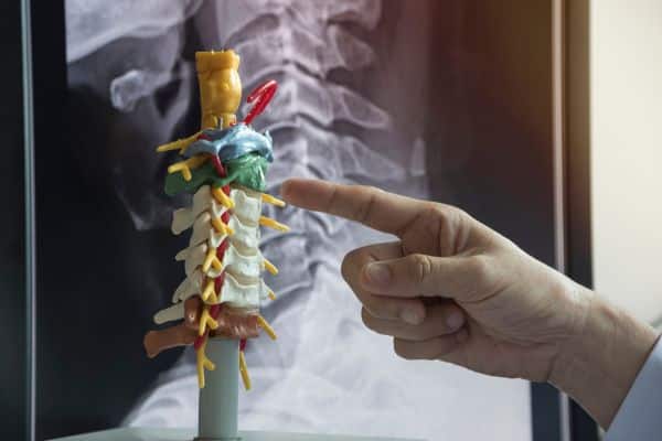 Cervical and Lumbar Radiculopathy