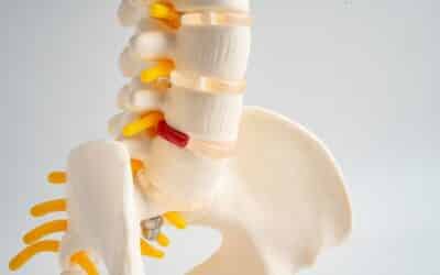 Herniated Disc vs Spinal Stenosis: How to Tell the Difference