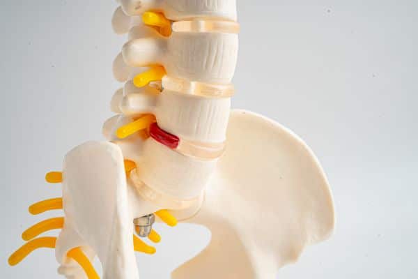 richard-francis-img Spinal Stenosis vs herniated disc