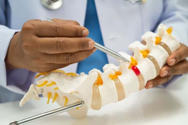 Spondylolisthesis Be Causing Your Back Pain